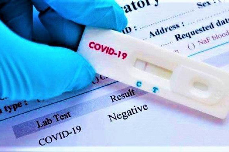 prueba-covid-coronavirus.jpg